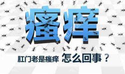 肛門瘙癢治不好嗎？先檢查病因就好辦！